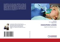 Produktbild: Endo/perio Lesion