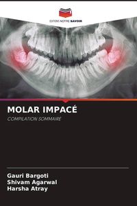 Produktbild: Molar Impac&eacute;