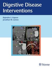 Produktbild: Digestive Disease Interventions