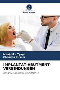 Produktbild: Implantat-Abutment-Verbindungen