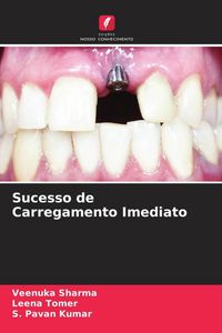 Produktbild: Sucesso de Carregamento Imediato