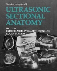 Produktbild: Ultrasonic Sectional Anatomy