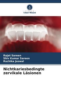 Produktbild: Nichtkariesbedingte zervikale L&auml;sionen