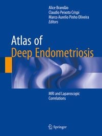 Produktbild: Atlas of Deep Endometriosis