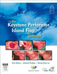 Produktbild: Keystone Island Flap Concept I