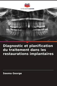 Produktbild: Diagnostic et planification du traitement dans les restaurations implantaires