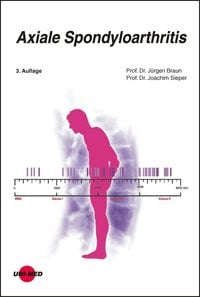 Produktbild: Axiale Spondyloarthritis