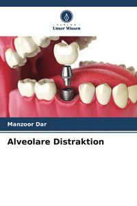 Produktbild: Alveolare Distraktion