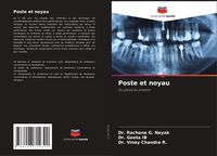 Produktbild: Poste et noyau