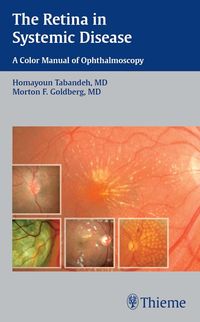 Produktbild: The Retina in Systemic Disease