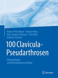 Produktbild: 100 Clavicula-Pseudarthrosen