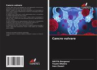 Produktbild: Cancro vulvare