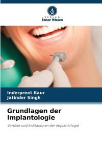 Produktbild: Grundlagen der Implantologie