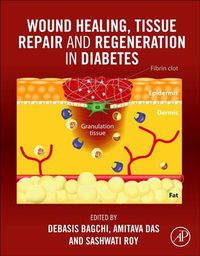 Produktbild: Wound Healing, Tissue Repair, and Regeneration in Diabetes