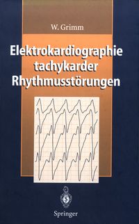Produktbild: Elektrokardiographie tachykarder Rhythmusst&ouml;rungen