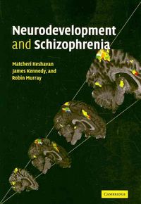 Produktbild: Neurodevelopment and Schizophrenia