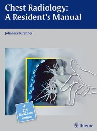 Produktbild: Chest Radiology: A Resident's Manual