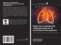 Produktbild: Papel de la tomograf&iacute;a computarizada en el carcinoma broncog&eacute;nico