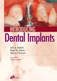 Produktbild: Introducing Dental Implants