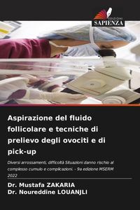 Produktbild: Aspirazione del fluido follicolare e tecniche di prelievo degli ovociti e di pick-up