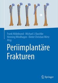Produktbild: Periimplant&auml;re Frakturen