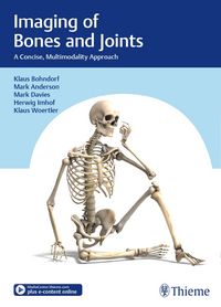 Produktbild: Imaging of Bones and Joints