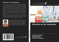 Produktbild: Oclusi&oacute;n en los implantes