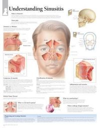 Produktbild: Understanding Sinusitis Chart