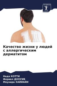 Produktbild: Kachestwo zhizni u l&uuml;dej s allergicheskim dermatitom