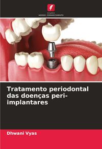 Produktbild: Tratamento periodontal das doen&ccedil;as peri-implantares