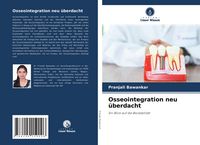 Produktbild: Osseointegration neu &uuml;berdacht