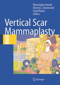 Produktbild: Vertical Scar Mammaplasty