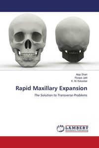 Produktbild: Rapid Maxillary Expansion