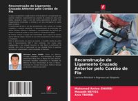 Produktbild: Reconstru&ccedil;&atilde;o do Ligamento Cruzado Anterior pelo Cord&atilde;o de Fio