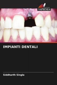 Produktbild: Impianti Dentali