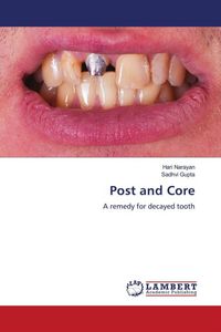 Produktbild: Post and Core