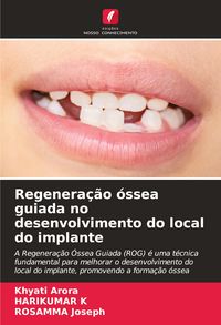 Produktbild: Regenera&ccedil;&atilde;o &oacute;ssea guiada no desenvolvimento do local do implante