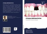 Produktbild: Otkazy Implantatov
