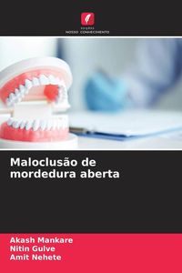 Produktbild: Maloclus&atilde;o de mordedura aberta