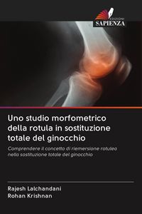 Produktbild: Uno studio morfometrico della rotula in sostituzione totale del ginocchio