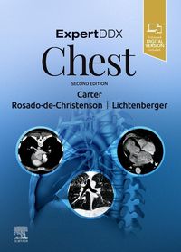 Produktbild: Expertddx: Chest