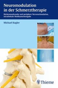 Produktbild: Neuromodulation in der Schmerztherapie