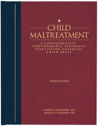 Produktbild: Child Maltreatment 3e, Volume 2