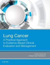 Produktbild: Lung Cancer: A Practical Approach to Evidence-Based Clinical Evaluation and Management