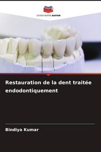 Produktbild: Restauration de la dent trait&eacute;e endodontiquement