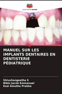 Produktbild: MANUEL SUR LES IMPLANTS DENTAIRES EN DENTISTERIE P&Eacute;DIATRIQUE