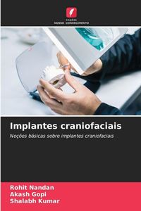 Produktbild: Implantes craniofaciais