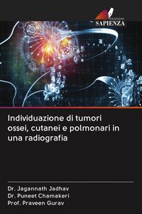 Produktbild: Individuazione di tumori ossei, cutanei e polmonari in una radiografia