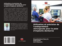 Produktbild: Utilisation et pr&eacute;cision de l'endoproth&egrave;se chirurgicale pour la pose d'implants dentaires