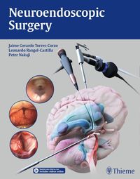 Produktbild: Neuroendoscopic Surgery